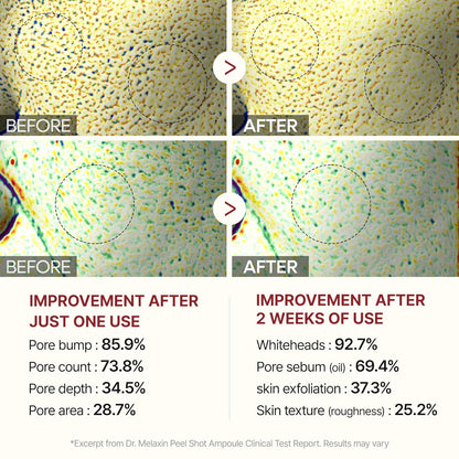 Dr.Melaxin Peel Shot Glow White and Black Rice Ampoule Duo